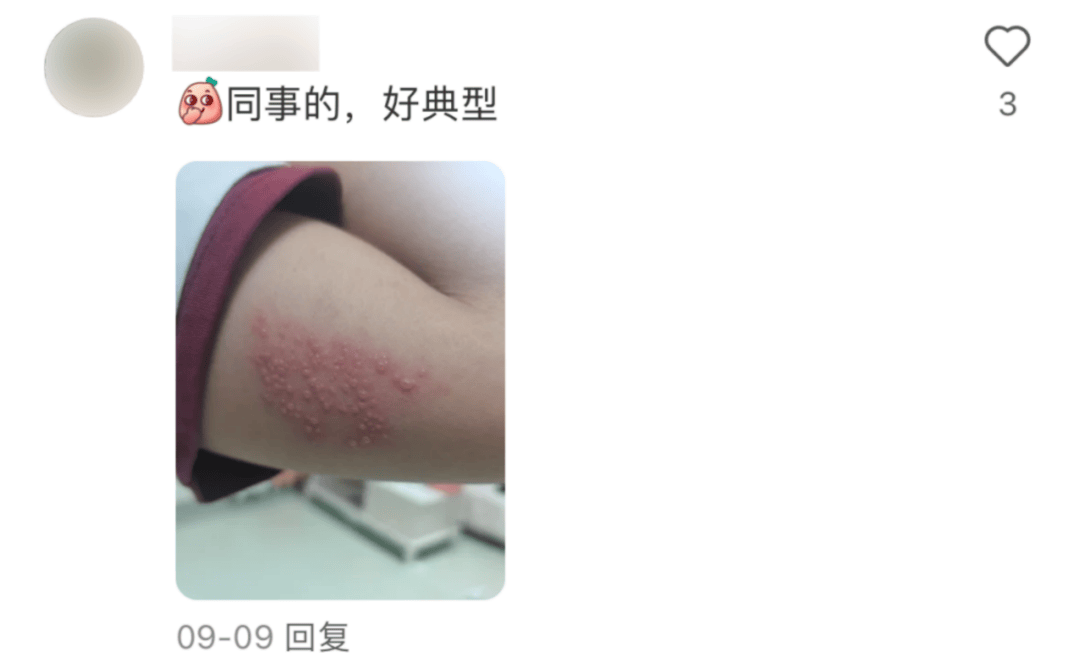 一旦感染终身携带<strong></p>
<p>以太行情</strong>！深圳疾控提醒：这4类人要注意