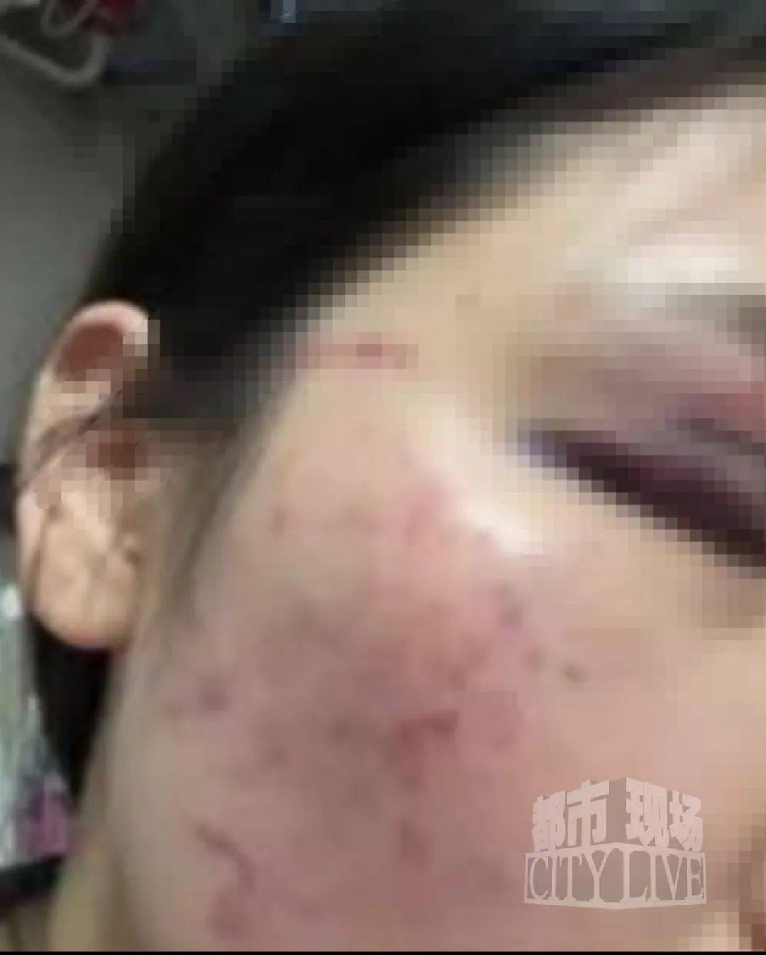 湖南衡阳29岁女子疑被男友施暴后从25楼跳下身亡 男友徐某此前还刺激说：“你放心<strong></p>
<p>欧意okex下载</strong>，她不会去死的”