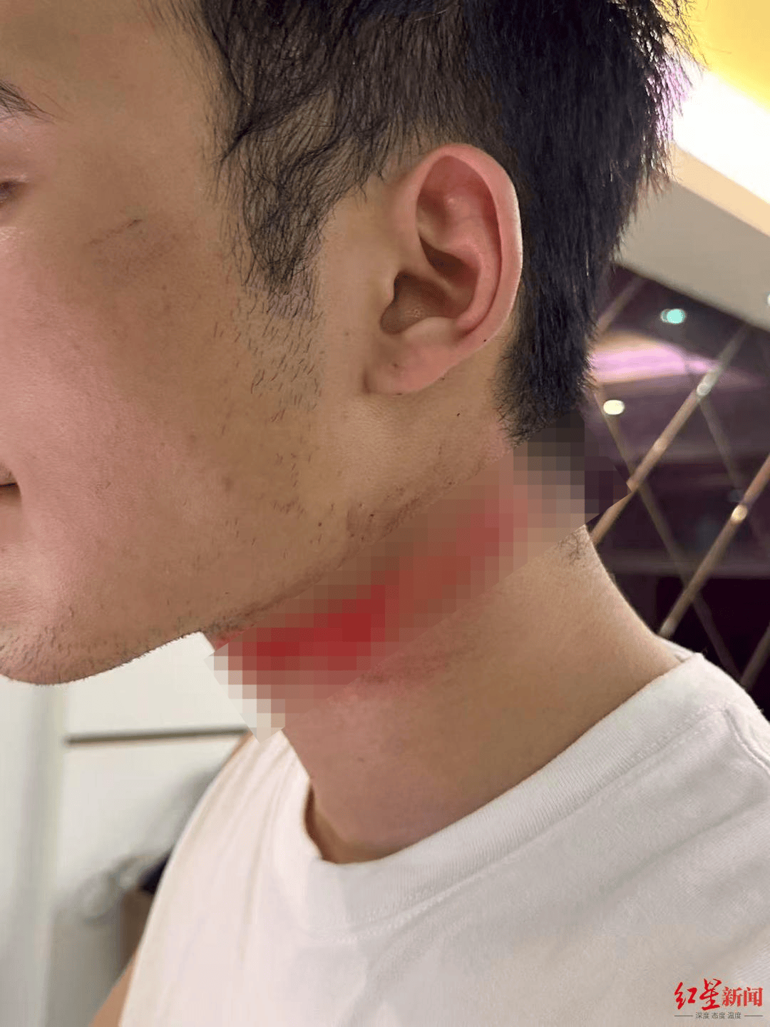 男主播骑车载女友回家被路边掉落网线勒伤脖子<strong></p>
<p>okex下载与安装苹果</strong>，索赔3万陷僵局 律师解读该谁赔